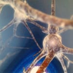 Новообразованные зрительные нервы